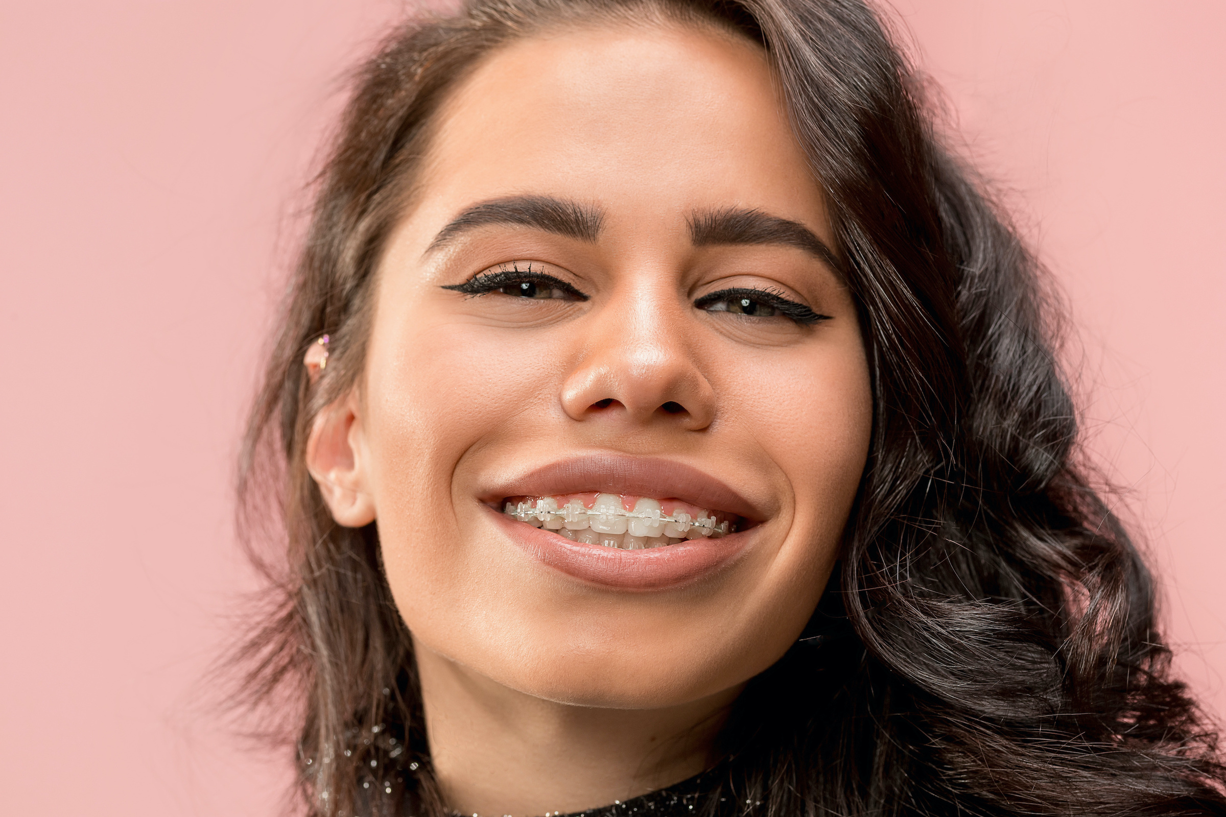Clear Braces Nellie Gail Orthodontics Braces & Invisalign Aliso
