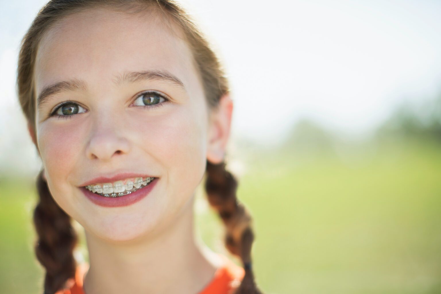 Clear Braces Nellie Gail Orthodontics Braces & Invisalign Aliso